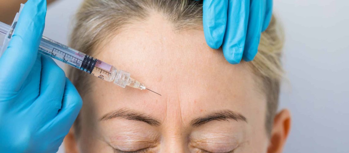 Does Microneedling Help Forehead Wrinkles? Scinature Aesthetics